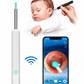 Earwax Removal Kit
